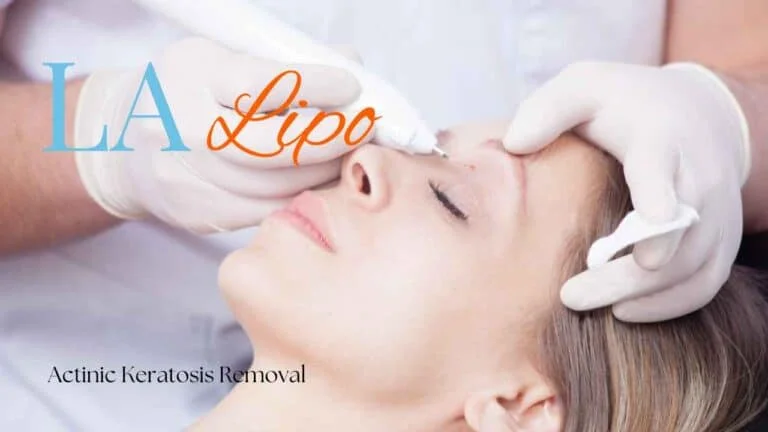 Woman receiving Actinic Keratosis Removal Treatment Hitchin