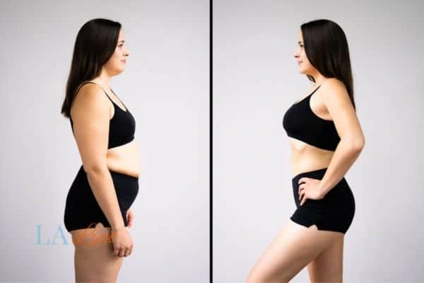 LA-EMS Body Sculpting Hitchin results before and after of womans results on body toning.