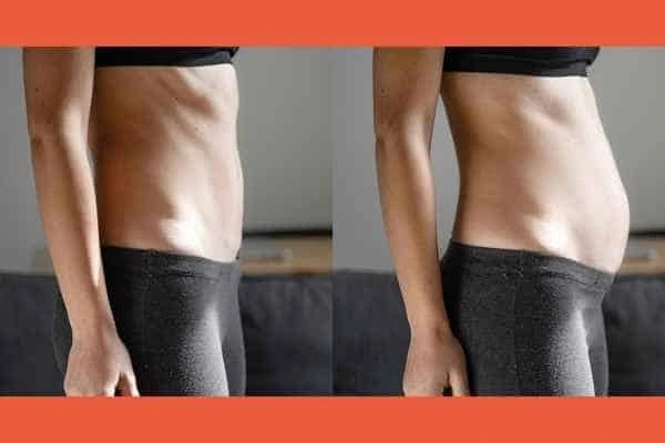 LA-EMS Body Sculpting results Hitchin