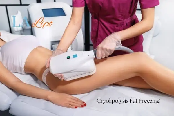 Woman receiving coolsculpting Hitchin treatment on her thighs