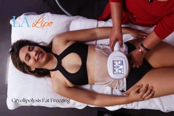 woman getting cryolipolysis Hitchin