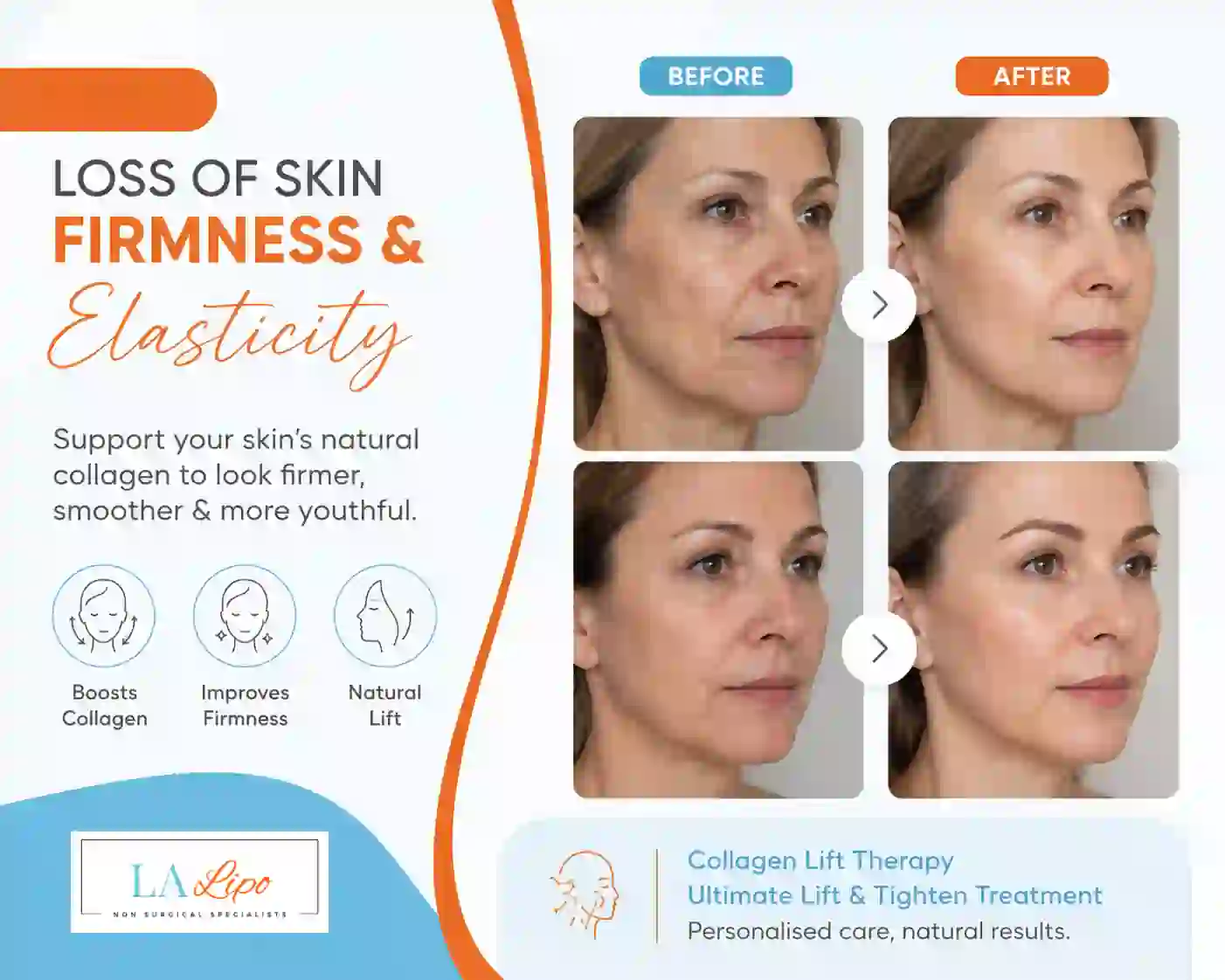 Sign #7: Loss of Skin Firmness and Elasticity Hitchin