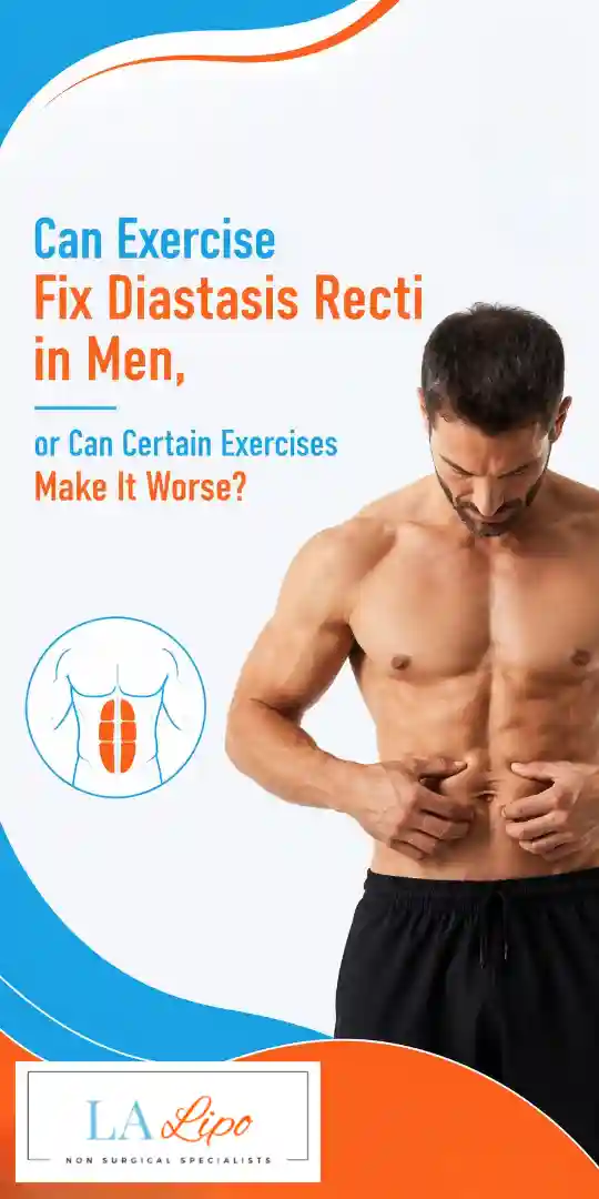 Can Exercise Fix Diastasis Recti in Men, or Can Certain Exercises Make It Worse Hitchin?